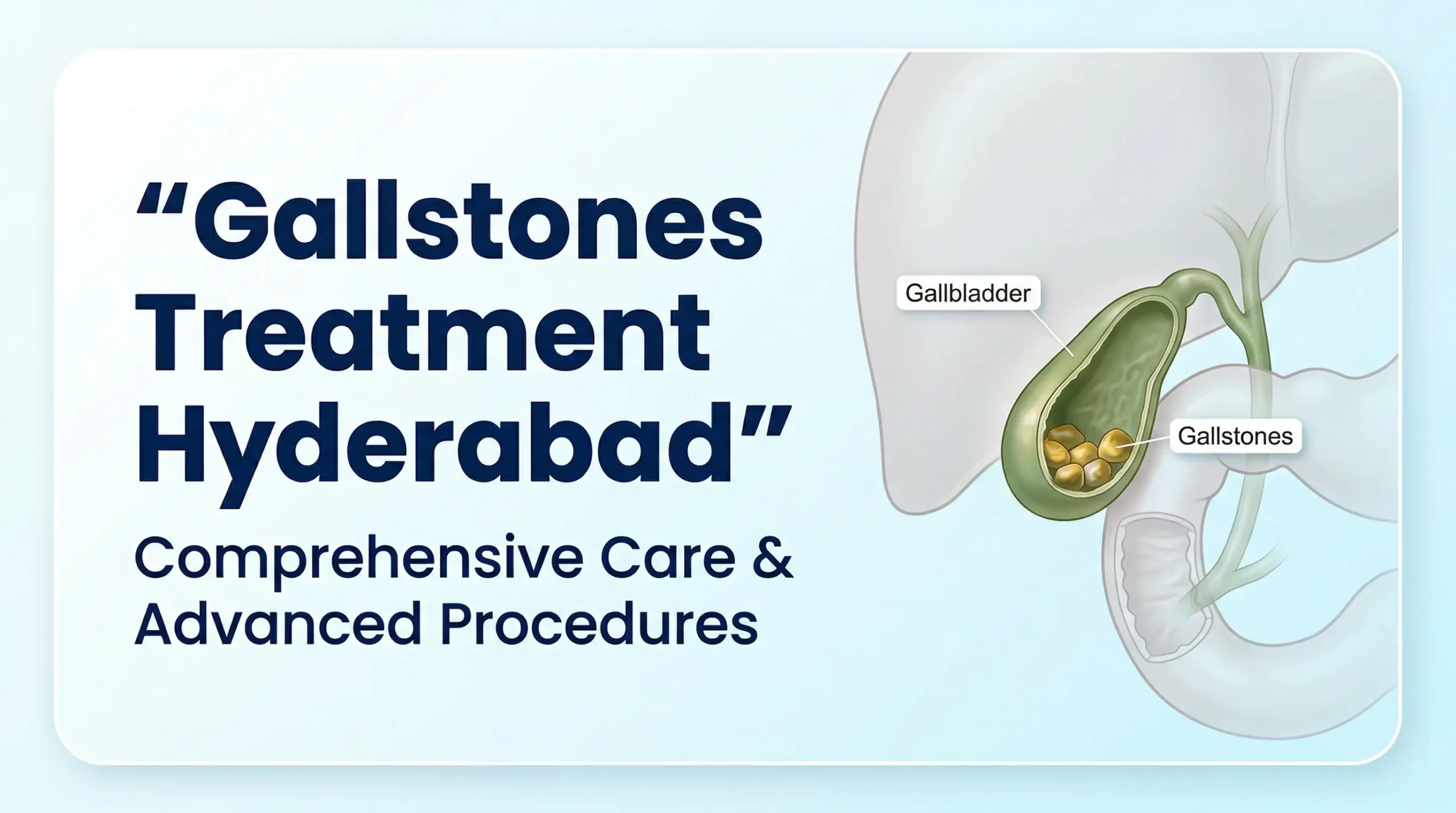 Gallstones and Gallbladder Treatment