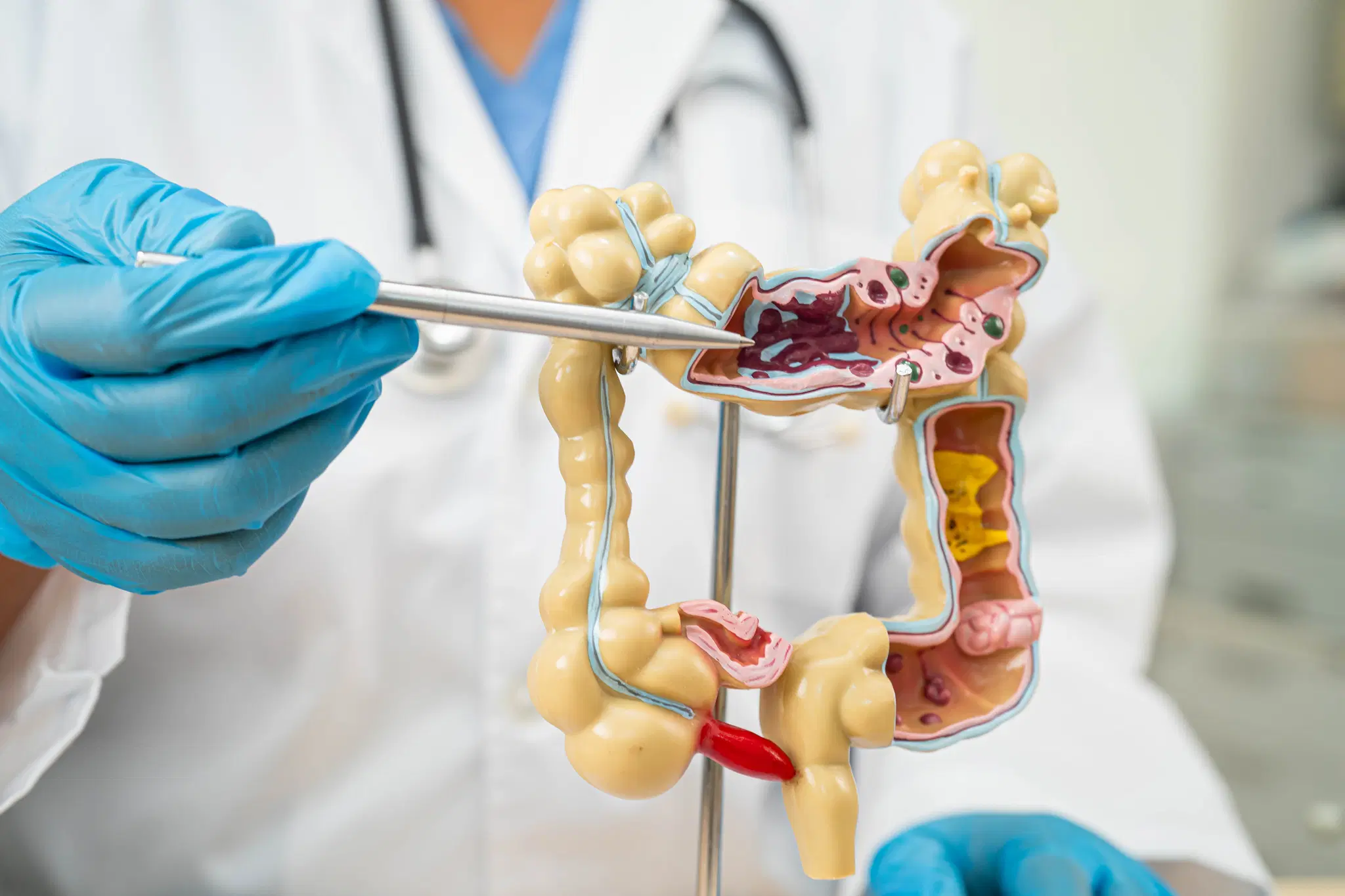 How Much Does Pile Laser Treatment Cost in Hyderabad?