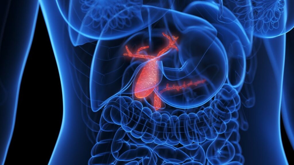 Best Treatment for Cholecystitis